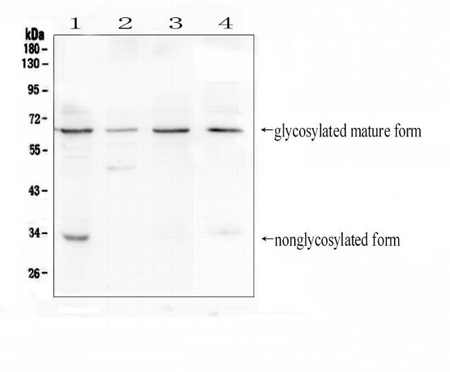 BTLA Antibody in Western Blot (WB)