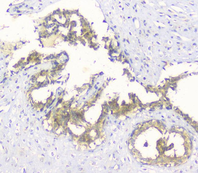 HAS1 Antibody in Immunohistochemistry (Paraffin) (IHC (P))