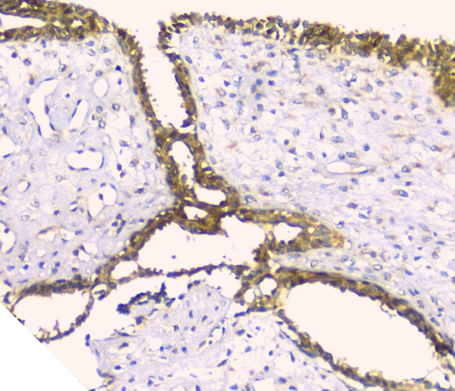 HAS1 Antibody in Immunohistochemistry (Paraffin) (IHC (P))