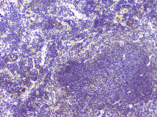 HAS1 Antibody in Immunohistochemistry (Paraffin) (IHC (P))