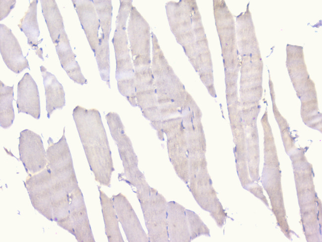 PCDH15 Antibody in Immunohistochemistry (Paraffin) (IHC (P))