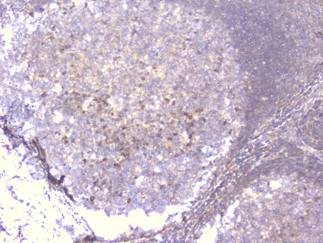 PCDH15 Antibody in Immunohistochemistry (Paraffin) (IHC (P))