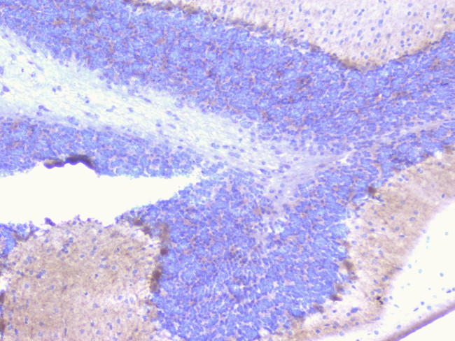 PCDH15 Antibody in Immunohistochemistry (Paraffin) (IHC (P))