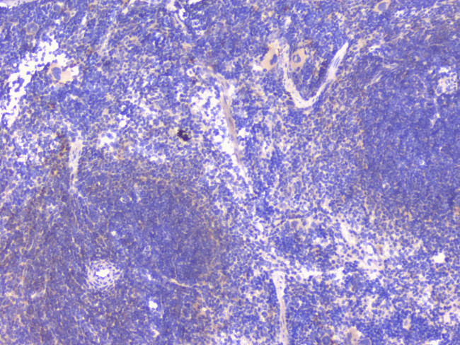 PCDH15 Antibody in Immunohistochemistry (Paraffin) (IHC (P))