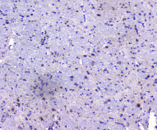 PCDH15 Antibody in Immunohistochemistry (Paraffin) (IHC (P))