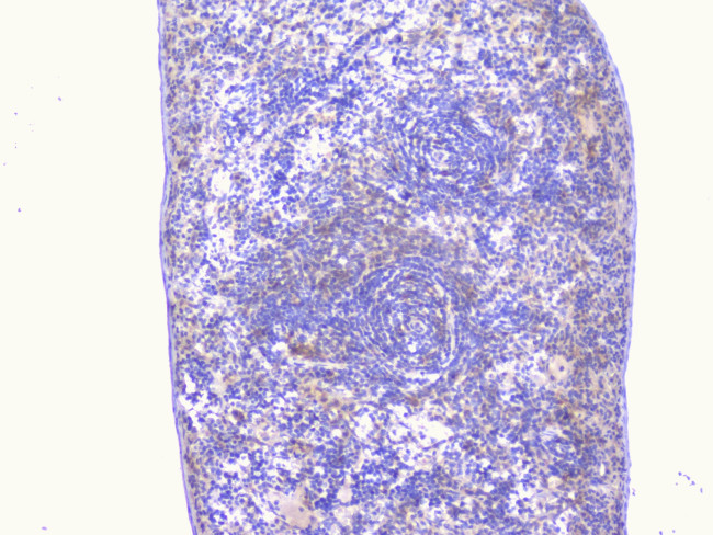 PCDH15 Antibody in Immunohistochemistry (Paraffin) (IHC (P))