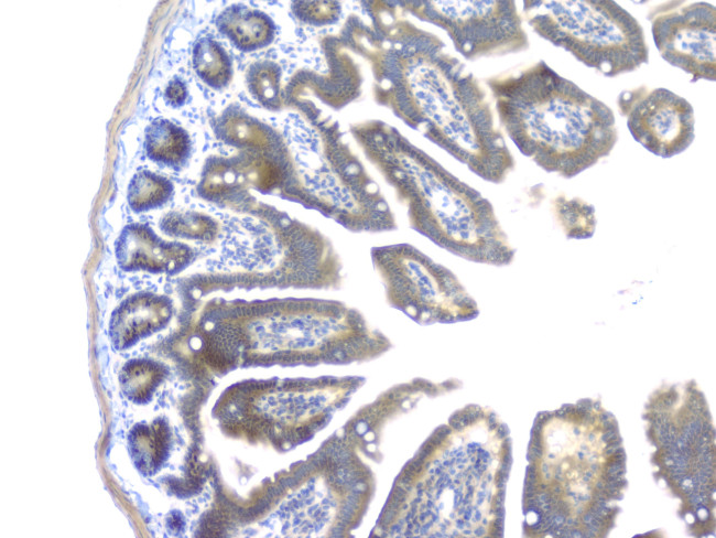 PKC beta-1 Antibody in Immunohistochemistry (Paraffin) (IHC (P))