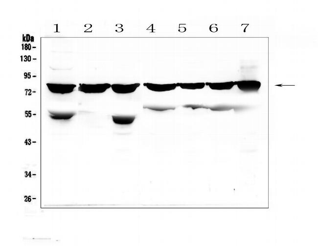 PKC beta-1 Antibody in Western Blot (WB)