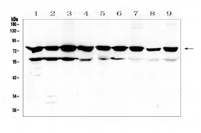 PKC beta-1 Antibody in Western Blot (WB)