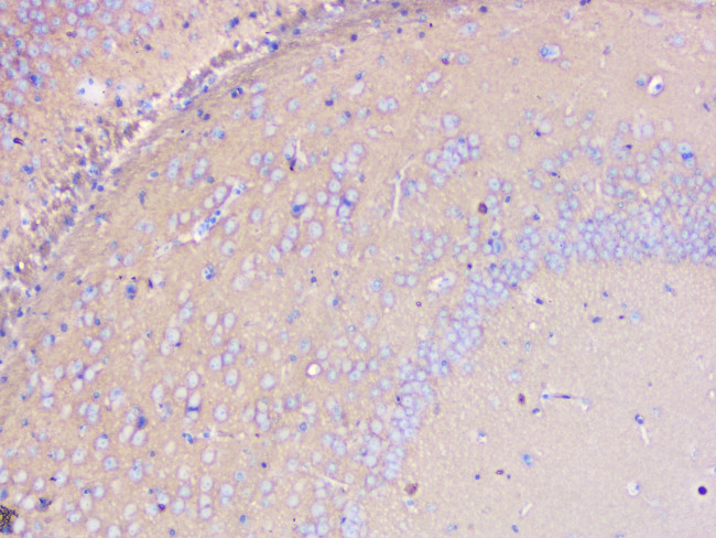 PKC gamma Antibody in Immunohistochemistry (Paraffin) (IHC (P))