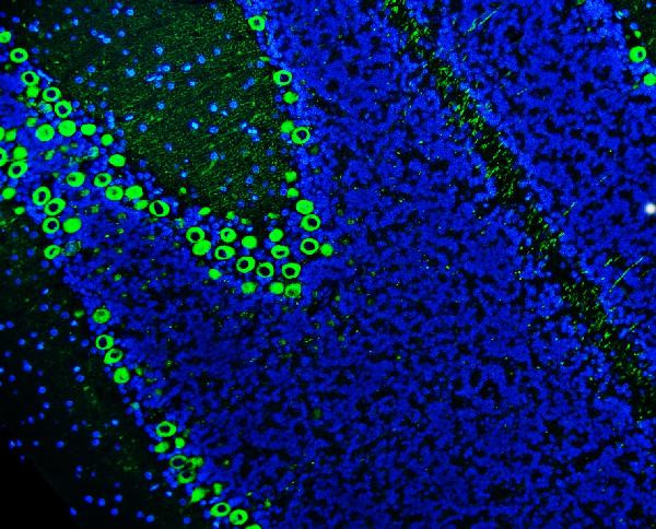 PKC gamma Antibody in Immunohistochemistry (Paraffin) (IHC (P))