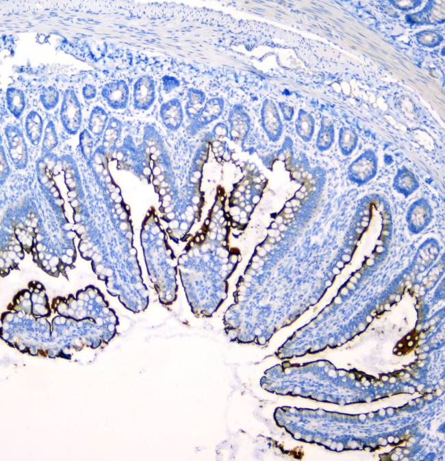 SI Antibody in Immunohistochemistry (Paraffin) (IHC (P))