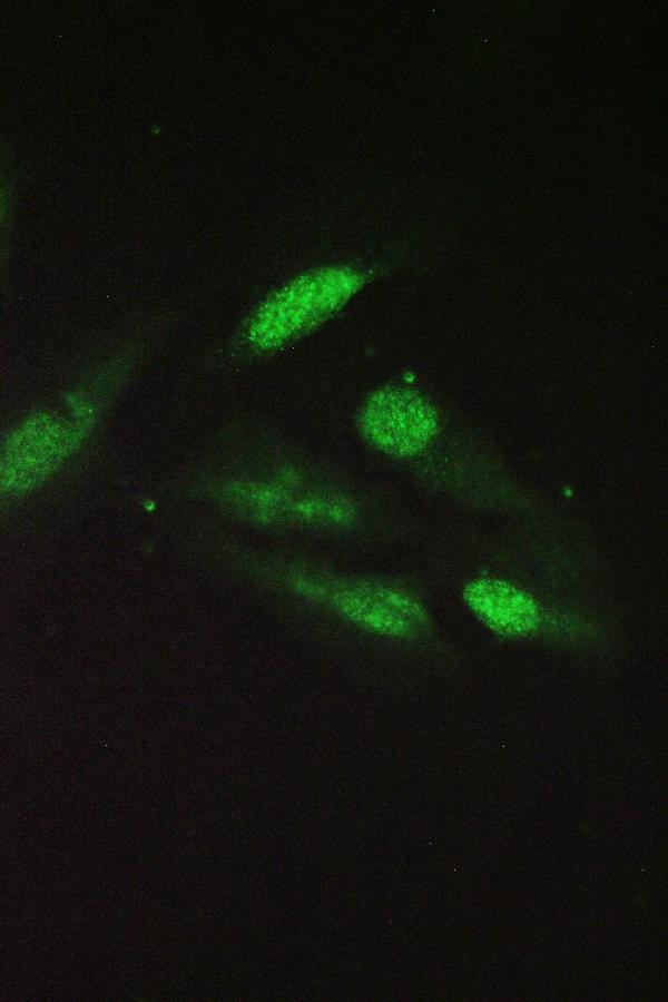 Sorcin Antibody in Immunocytochemistry (ICC/IF)