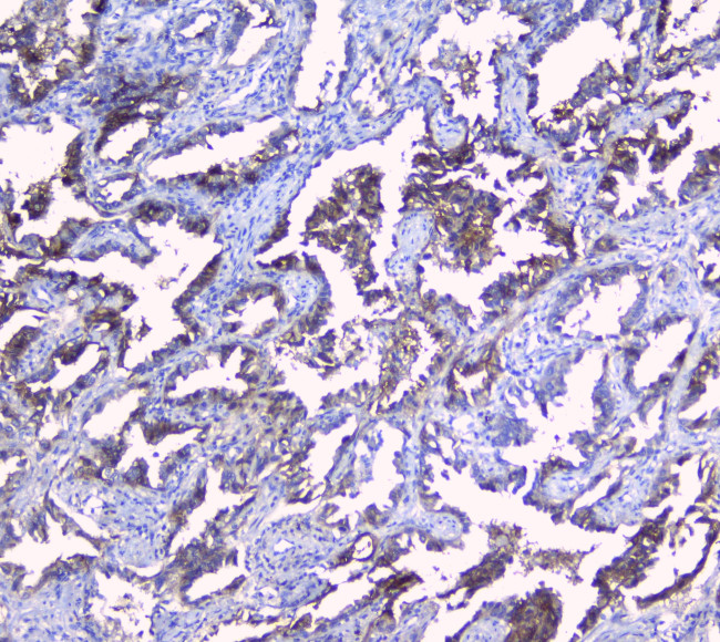 Sorcin Antibody in Immunohistochemistry (Paraffin) (IHC (P))