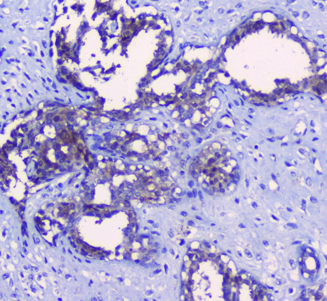 Sorcin Antibody in Immunohistochemistry (Paraffin) (IHC (P))