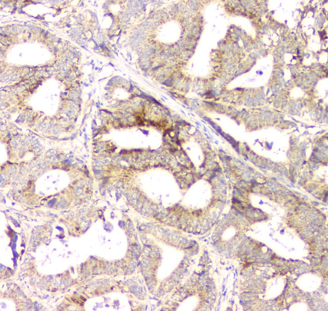 APRT Antibody in Immunohistochemistry (Paraffin) (IHC (P))