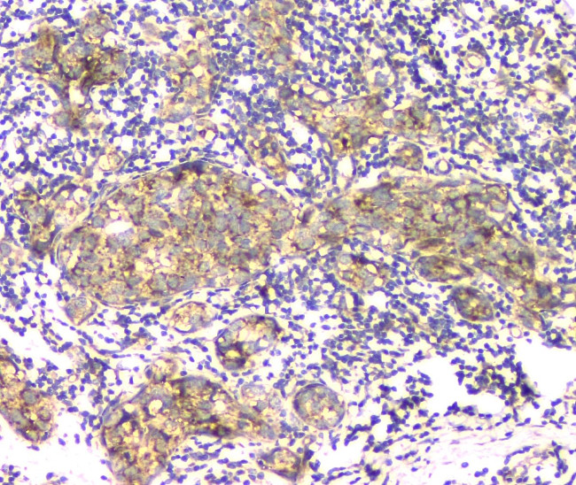 APRT Antibody in Immunohistochemistry (Paraffin) (IHC (P))