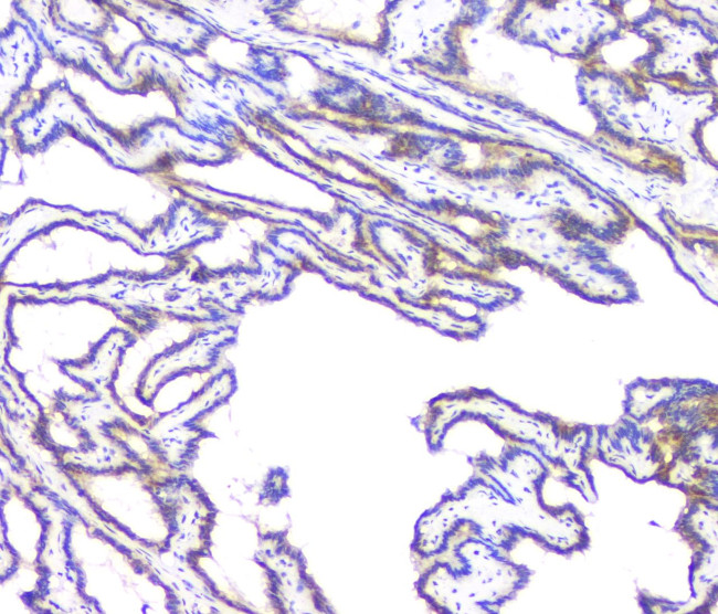 BAG6 Antibody in Immunohistochemistry (Paraffin) (IHC (P))