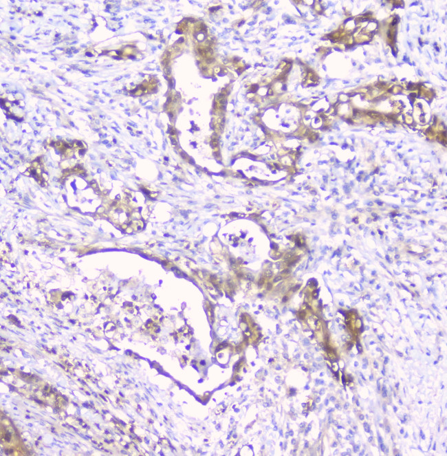 CDA Antibody in Immunohistochemistry (Paraffin) (IHC (P))