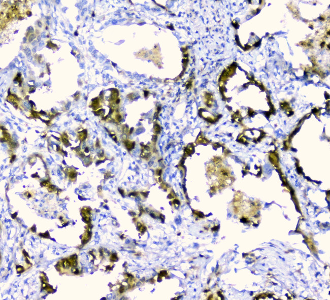 CDA Antibody in Immunohistochemistry (Paraffin) (IHC (P))