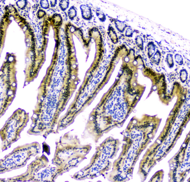 CDA Antibody in Immunohistochemistry (Paraffin) (IHC (P))