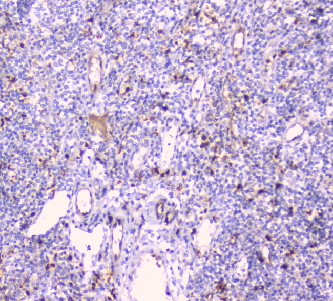 CDA Antibody in Immunohistochemistry (Paraffin) (IHC (P))