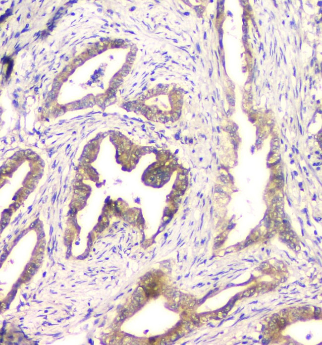 CHM Antibody in Immunohistochemistry (Paraffin) (IHC (P))