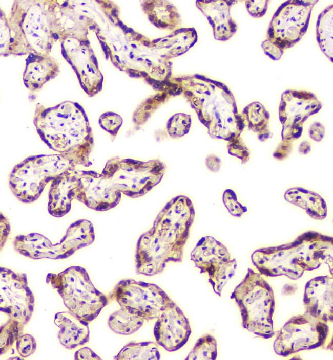 CHM Antibody in Immunohistochemistry (Paraffin) (IHC (P))