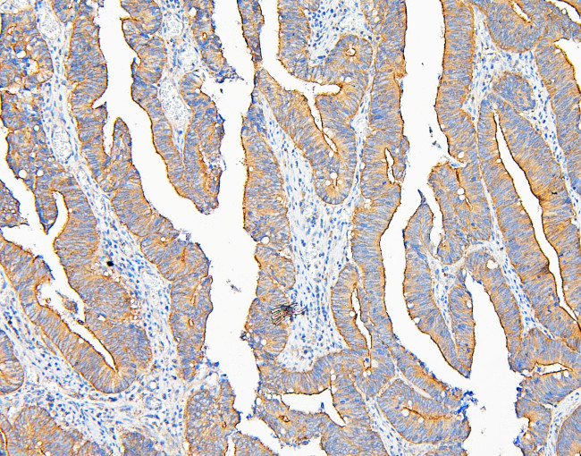 IQGAP1 Antibody in Immunohistochemistry (Paraffin) (IHC (P))