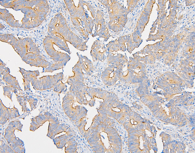 IQGAP1 Antibody in Immunohistochemistry (Paraffin) (IHC (P))