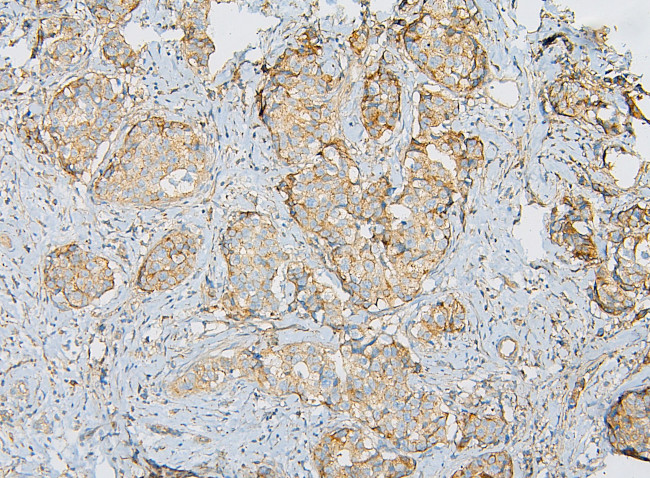 IQGAP1 Antibody in Immunohistochemistry (Paraffin) (IHC (P))