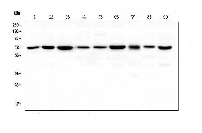 KBTBD2 Antibody in Western Blot (WB)