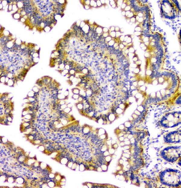 PPCS Antibody in Immunohistochemistry (Paraffin) (IHC (P))