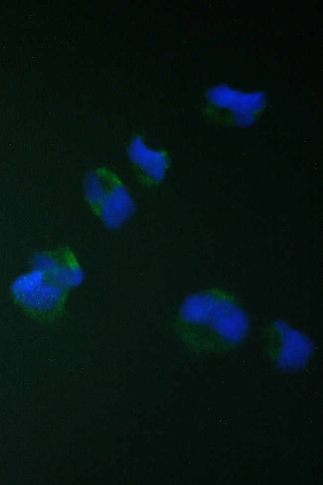 TIM17 Antibody in Immunocytochemistry (ICC/IF)