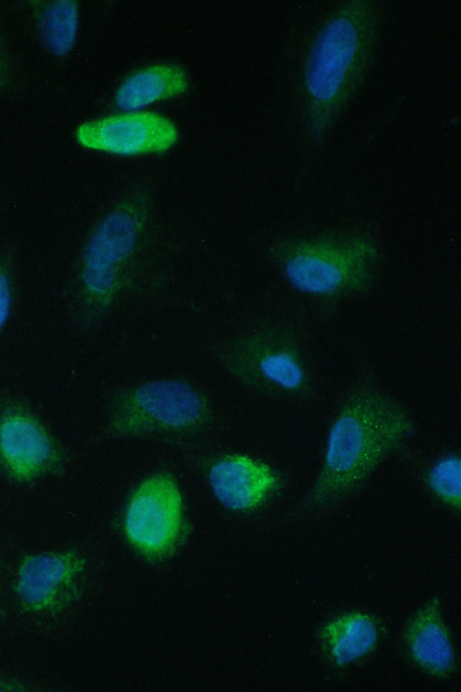 TIM17 Antibody in Immunocytochemistry (ICC/IF)