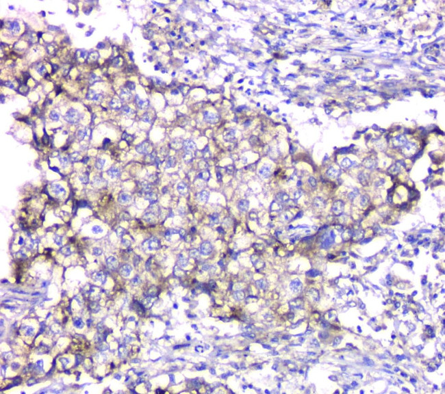 TIM17 Antibody in Immunohistochemistry (Paraffin) (IHC (P))