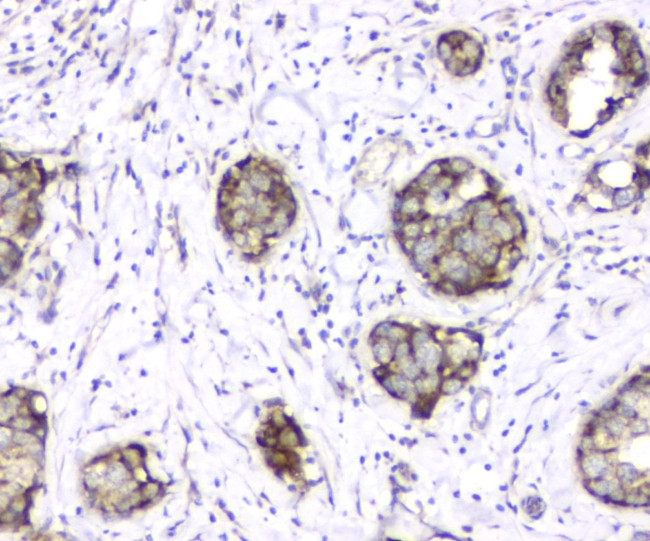 TIM17 Antibody in Immunohistochemistry (Paraffin) (IHC (P))