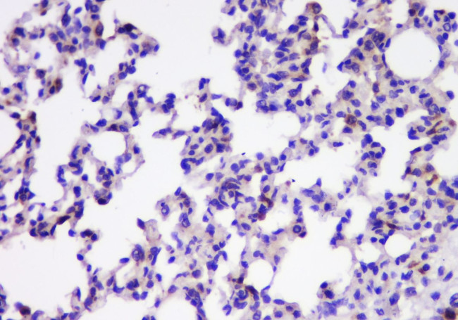 TIM17 Antibody in Immunohistochemistry (Paraffin) (IHC (P))