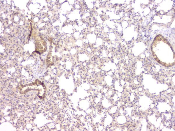 TIM17 Antibody in Immunohistochemistry (Paraffin) (IHC (P))