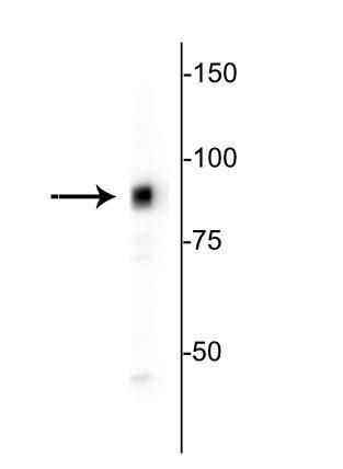 MARCKS Antibody in Western Blot (WB)