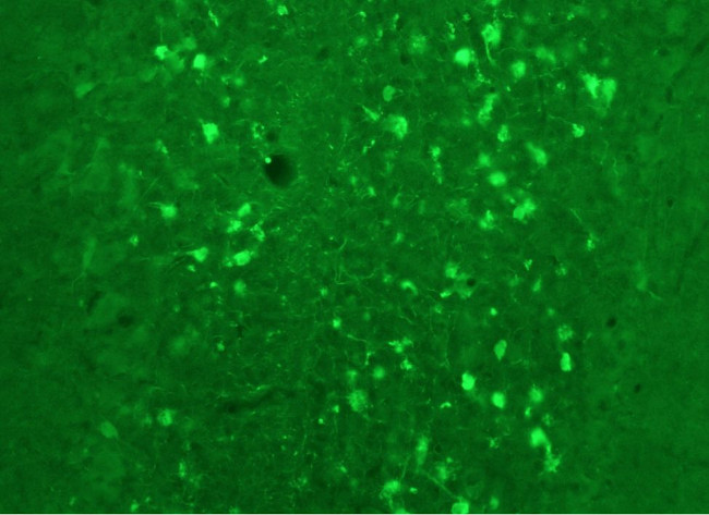 Calretinin Antibody in Immunohistochemistry (IHC)