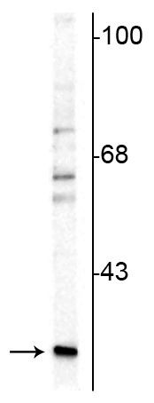 Calretinin Antibody in Western Blot (WB)