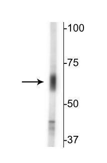 SLC6A13 Antibody in Western Blot (WB)