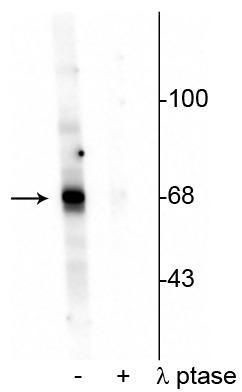 Phospho-AKT1 (Thr342) Antibody in Western Blot (WB)