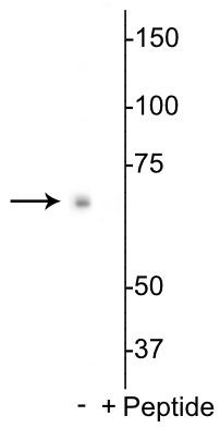 Phospho-p70 S6 Kinase (Ser398) Antibody in Western Blot (WB)