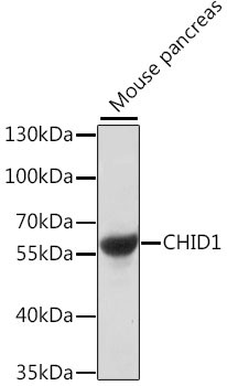 SI-CLP Antibody in Western Blot (WB)