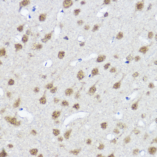 MYOCD Antibody in Immunohistochemistry (Paraffin) (IHC (P))