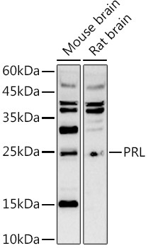 Prolactin Antibody in Western Blot (WB)