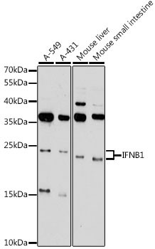 IFN beta Antibody in Western Blot (WB)