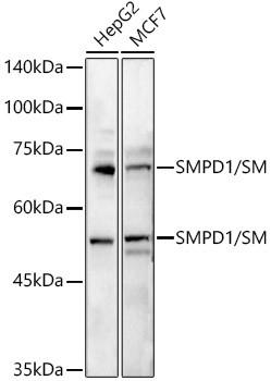 ASM Antibody in Western Blot (WB)